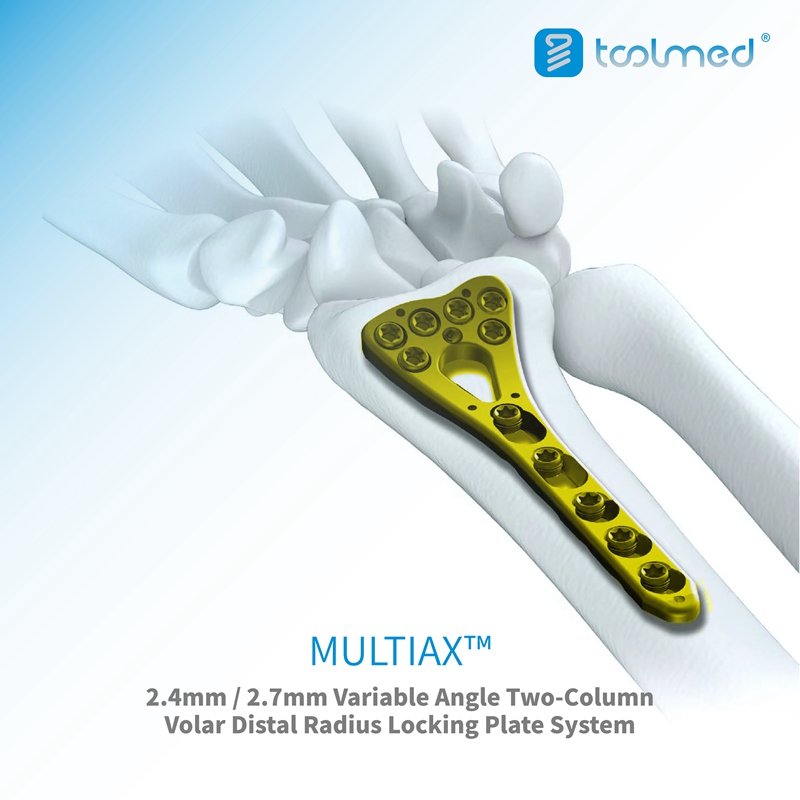 MULTIAX™ Variable Angle Two-Column Volar Distal Radius Locking Plate System